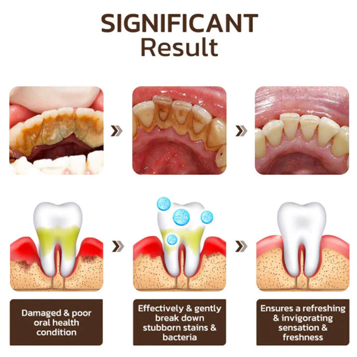 Niacinamide Whitening Toothpaste