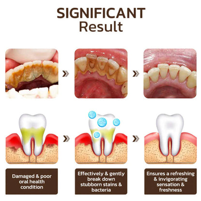 Niacinamide Whitening Toothpaste