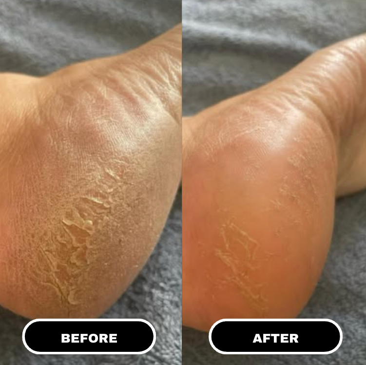 LuxeSole™ Foot Care Stick