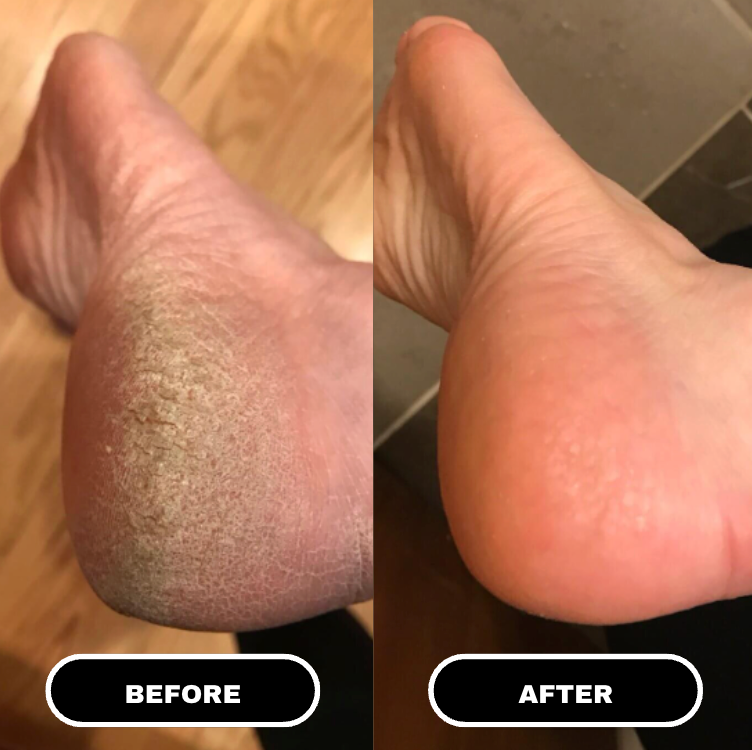 LuxeSole™ Foot Care Stick
