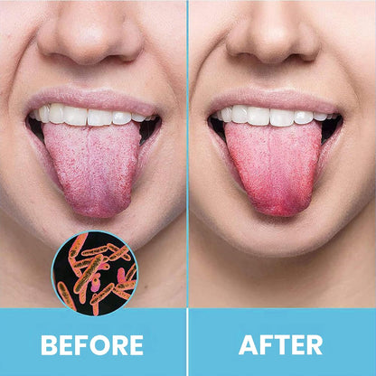 Ivy Smile™ Stainless Steel Tongue Cleaner